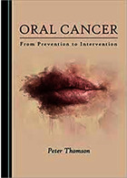 Oral Cancer, 1st Edition2019 سرطان دهان